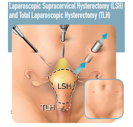 Laparoscopic Surgeon